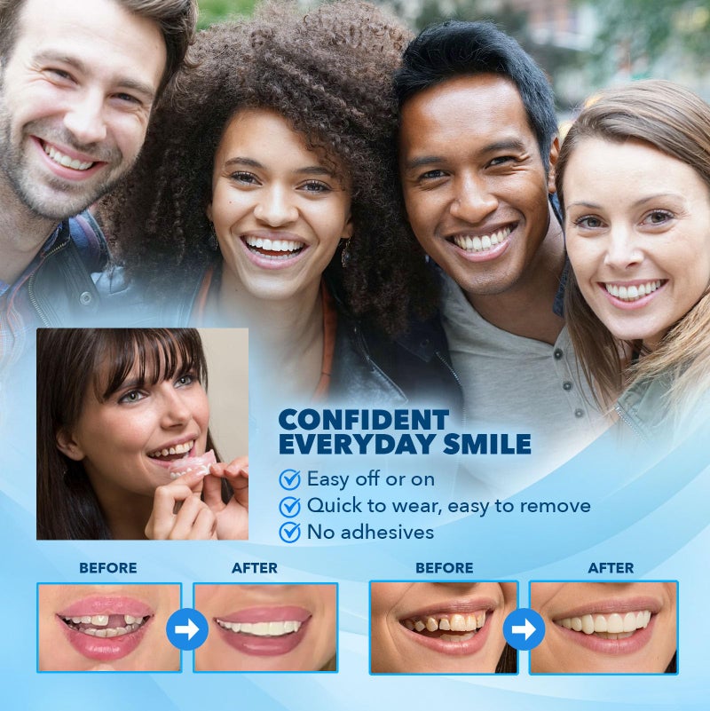 Imako Premium Cosmetic Uppers - 2 Pack - Small, Bleached White - DIY Smile Makeover - Made in USA - Image 2